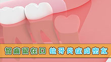 智齒留在口 蛀牙 炎症成密友