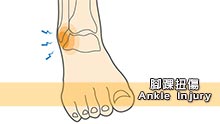 腳踝扭傷 -拗柴