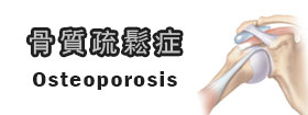 骨質疏鬆症 - Osteoporosis
