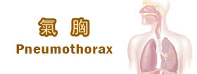 氣胸 - Pneumothorax