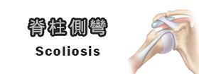 脊柱側彎[Scoliosis]