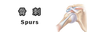 骨刺[Spurs]