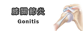 膝關節炎[Gonitis]