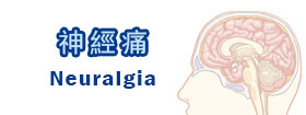 神經痛 - neuralgia