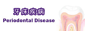 牙床疾病 - Periodontal Disease