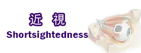 近視 - shortsightedness