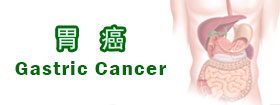 胃癌[Gastric Cancer]