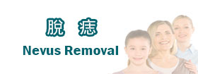 脫痣 - Nevus Removal