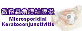 微孢蟲角膜結膜炎  - Microsporidial keratoconjunctivitis  