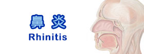 鼻炎 - Rhinitis