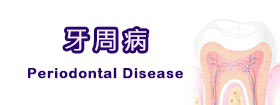 牙周病 - Periodontal Disease