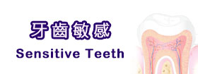 牙齒敏感[Sensitive Teeth]