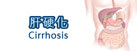 肝硬化 - Cirrhosis
