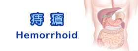 痔瘡[Hemorrhoid]