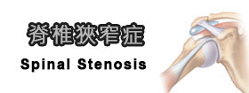脊椎狹窄症 - Spinal Stenosis