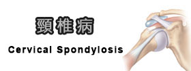 頸椎病[Cervical Spondylosis]