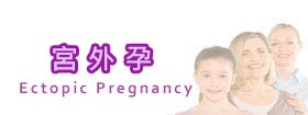 宮外孕 - Ectopic Pregnancy