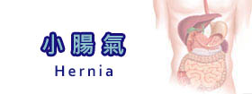 小腸氣 - Hernia