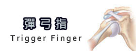彈弓指[Trigger Finger]