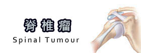 脊椎瘤 - Spinal Tumour