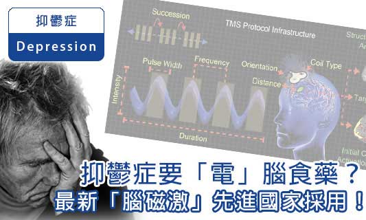 抑鬱症要「電」腦食藥？
最新「腦磁激」先進國家採用！