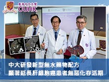 中大研發新型無水藥物配方 顯著延長肝細胞癌患者無惡化存活期